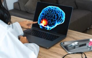 Doctor showing a x-ray of pain in the brain on a laptop.