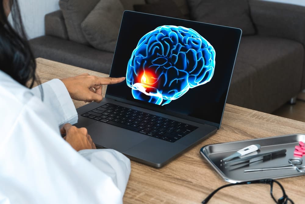 Can a Car Accident Cause Brain Injury Doctor showing a x-ray of pain in the brain on a laptop.